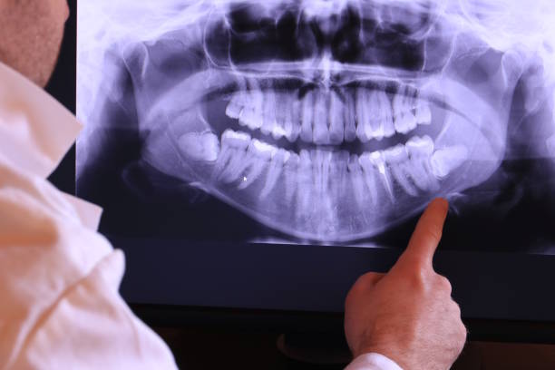 Best Broken Tooth Emergency  in Gardnerville Ranchos, NV